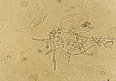 Imidazole: Heterocyclic Chemistry, Antifungal Drugs, and Buffer Systems
